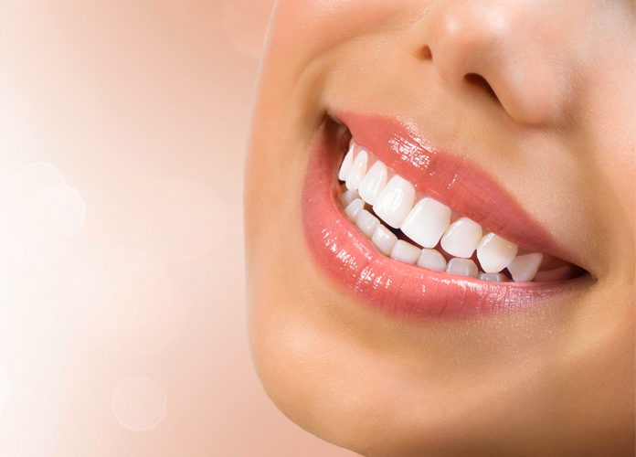 Teeth Whitening